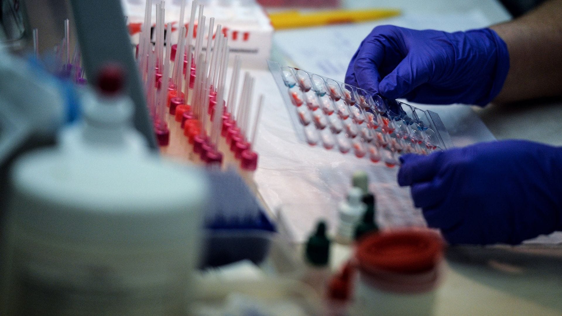 The Secret to Long Life May Be Found in a Blood Test