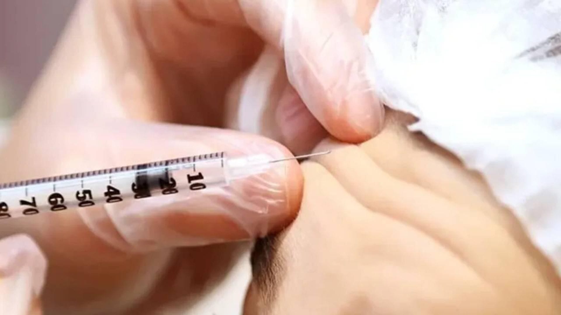 Evde Uygulanan Botoks İşlemi Genç Kadının Göz Kapağını Düştü: 7 Yıla Kadar Hapis Cezası İsteniyor
