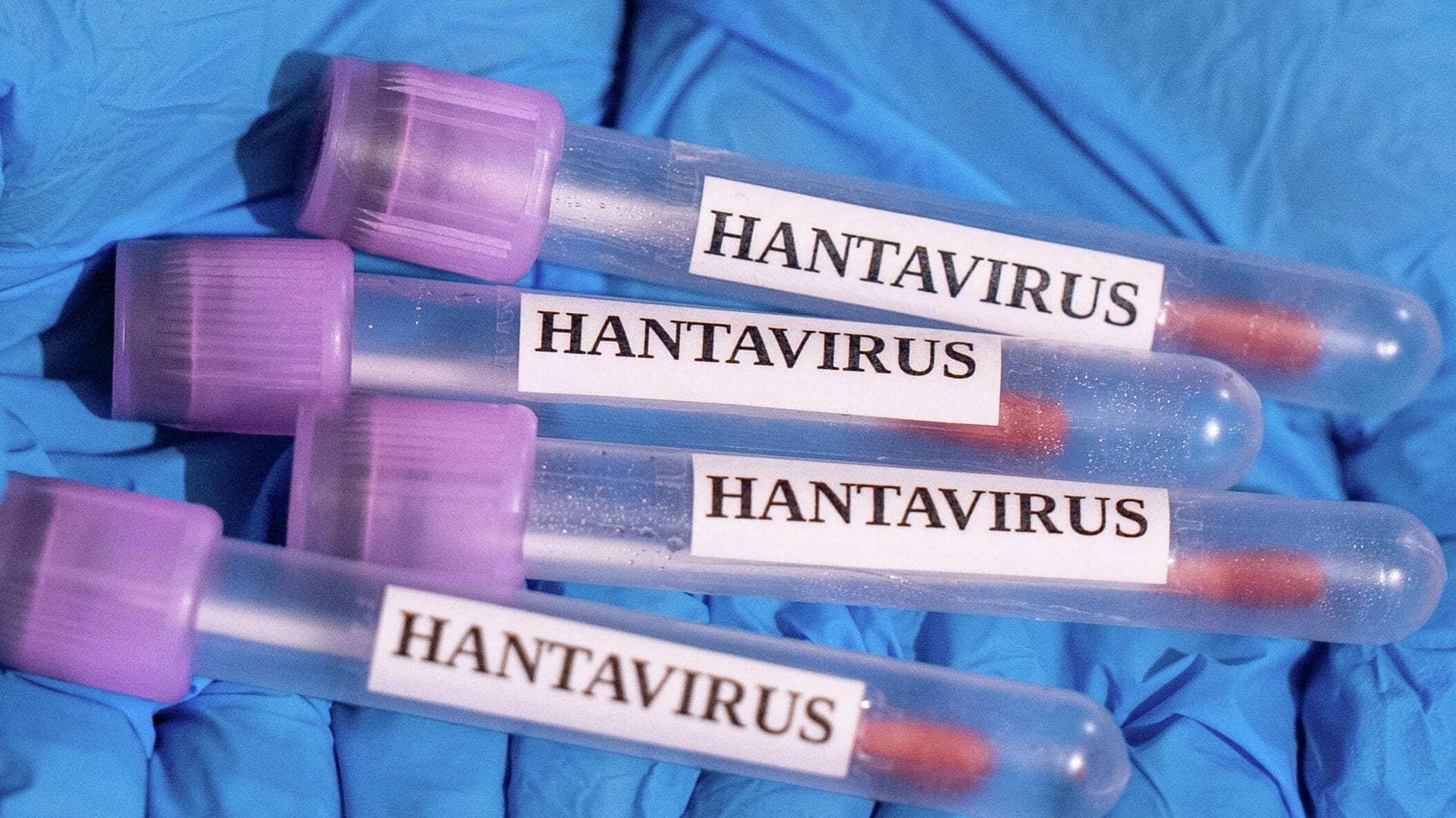Hantavirüs Salgınıyla İlgili Güncel Gelişme