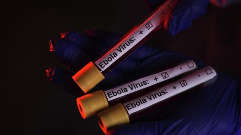 Kongo Demokratik Cumhuriyeti’nde Ebola Salgını Vaka Sayısı 3 Bin Geçti