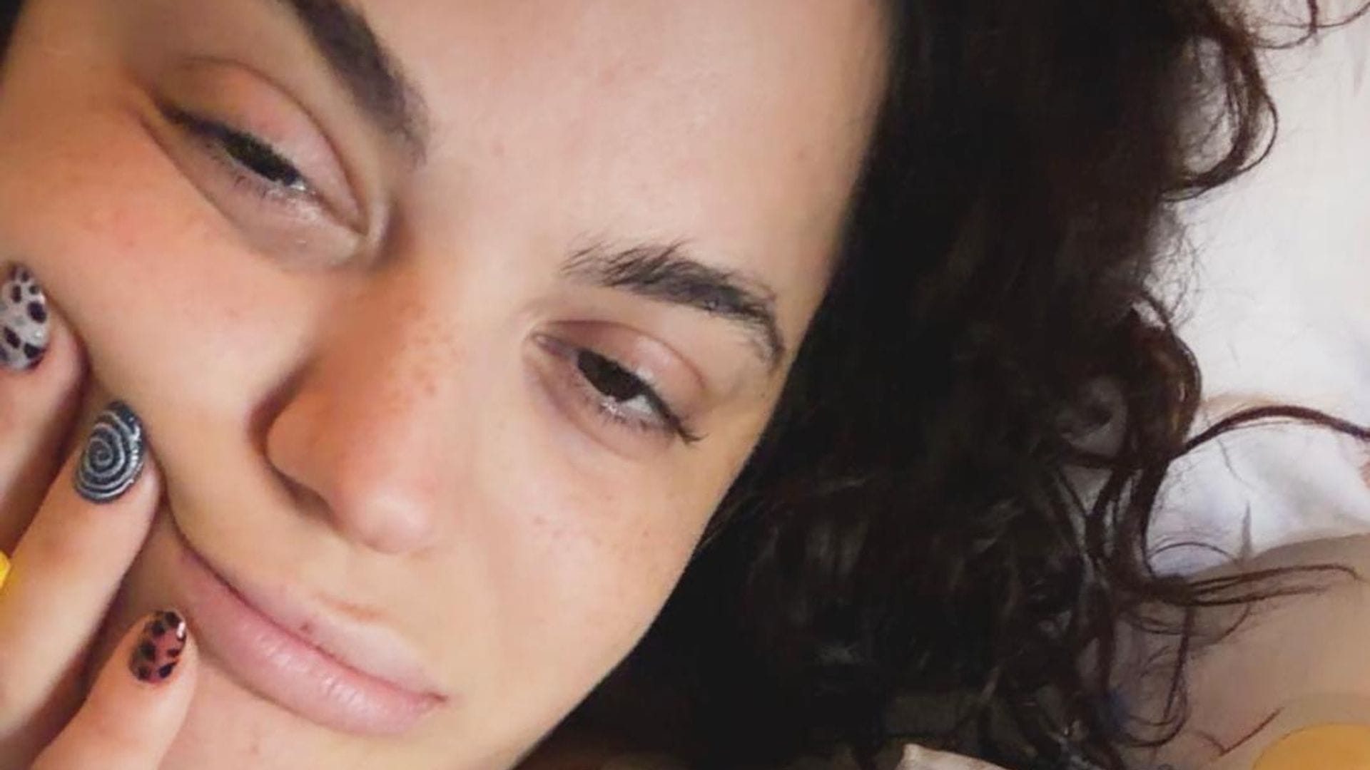 Aslı Bekiroğlu’nün 9. Ameliyatı Yakındır